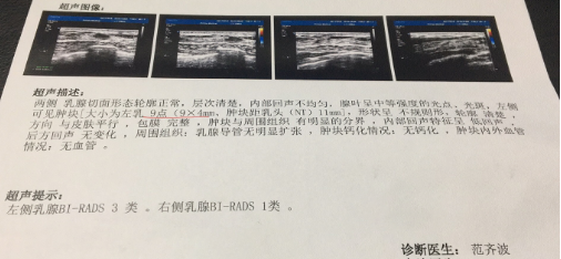 胸部疼一个星期了怎么回事