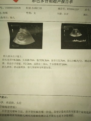 两个月胎儿图片