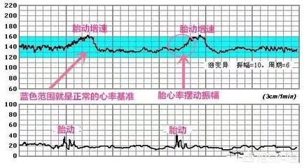 几个月做胎心监护