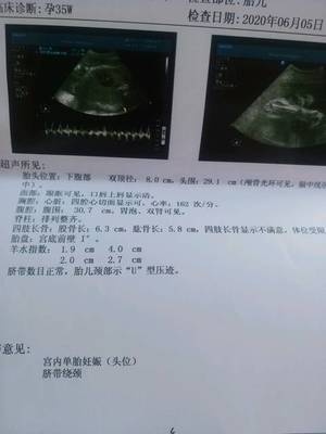 孕35周几个月