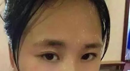 额头总出汗是怎么回事