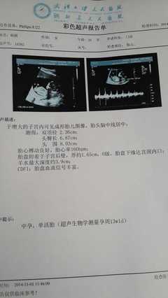 怀孕去检查要多少钱