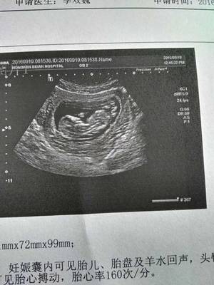 怀孕几个月能看出来男女