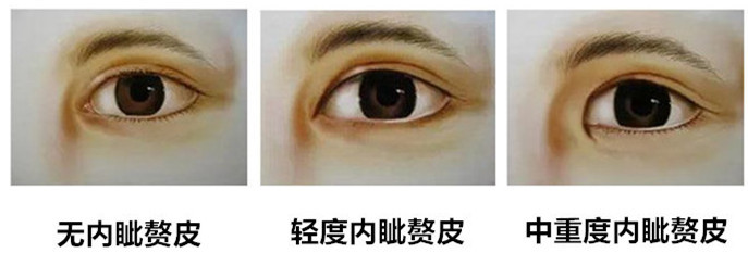 那些眼睛不适合开眼角