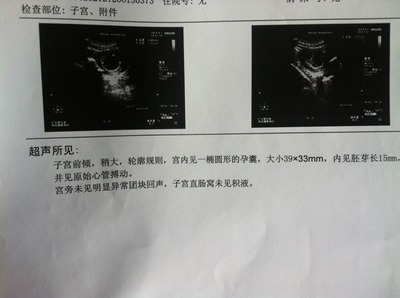 怀孕多久有心管搏动