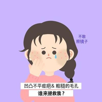 为什么长痘痘不能吃糖