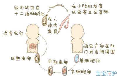 如何判断肚子里有蛔虫