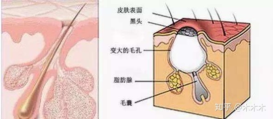 卵泡多怎么治疗