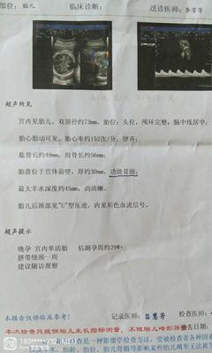 怀孕33周几个月