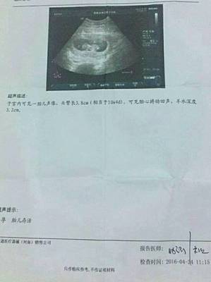 3月怀孕预产期是几月