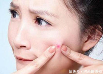 长痘痘最主要原因