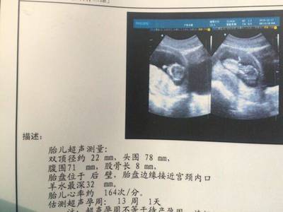 胎盘后壁几个月显怀