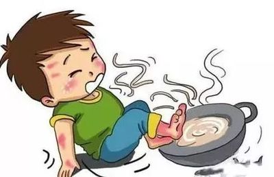 2岁宝宝吃酱油的危害