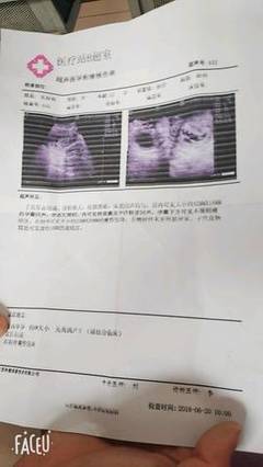 流产多久能怀孕