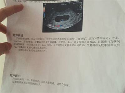 31周是怀孕几个月