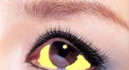 白眼珠多的人什么命