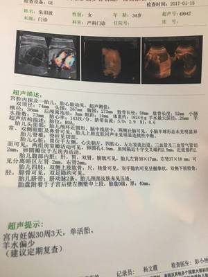 怀孕30周真实胎儿图片