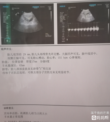 孕15周胎心多少正常