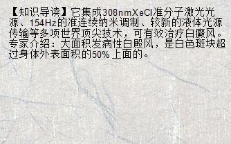 色素减退斑怎么治疗