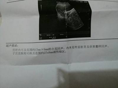 怀孕第一个月有月经吗