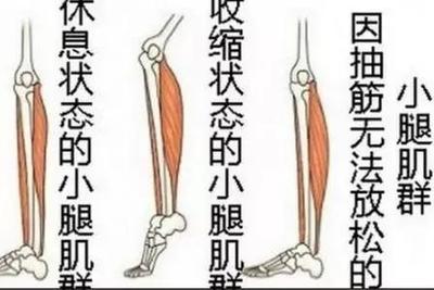 身体痉挛是怎么回事
