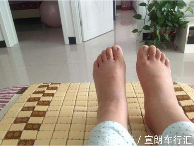 老人脚浮肿是怎么回事