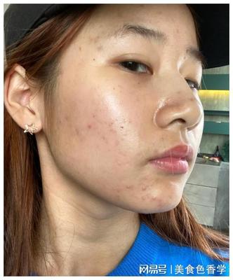 化妆时脸上起皮怎么办