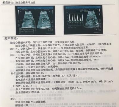 孕妇需要做心脏彩超吗