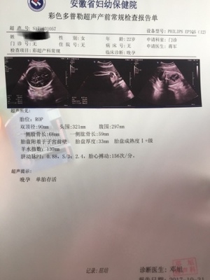 孕35周几个月