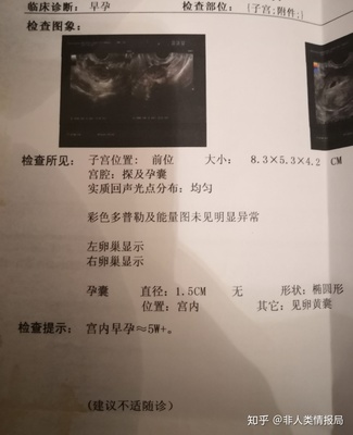 双侧卵巢多囊会怀孕吗