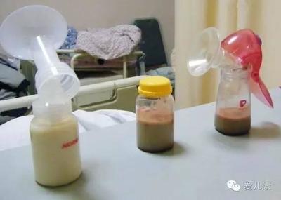 哺乳期停经是怎么回事