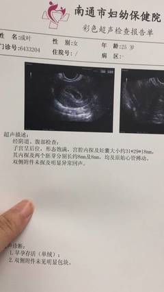 孕囊里没有胚芽是怎么回事