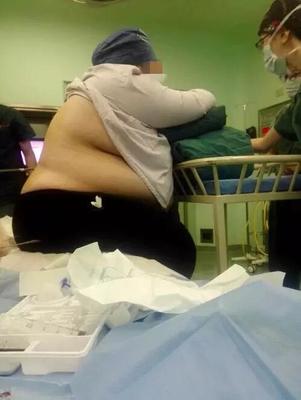 孕妇打麻药