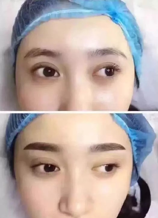 半永久眉毛失败案例