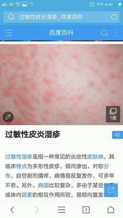 八个月宝宝皮肤过敏图