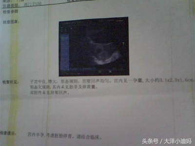 怀孕三个月胎儿多少斤