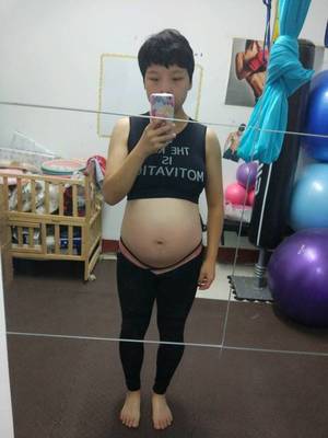 没怀孕会有妊娠线吗