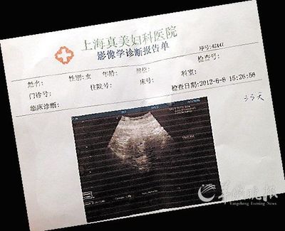 怀孕一个月胎儿有多大