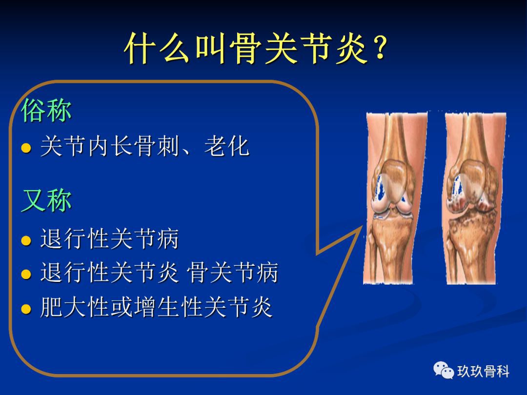 膝盖关节骨刺怎么治疗