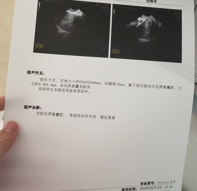 例假后多少天是排卵期