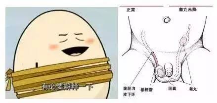 男孩隐睾是怎么回事