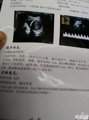 30周胎儿图片