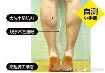 男生瘦臀抽脂