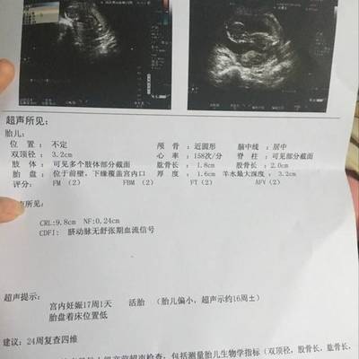 怀孕四个月胎盘低怎么办