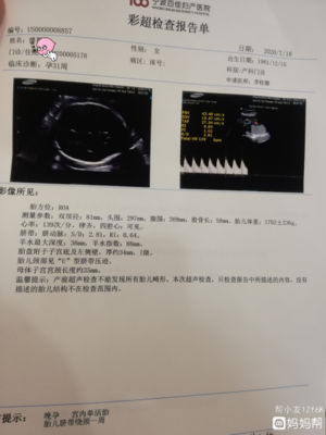 胎儿肝脏的大小是多少