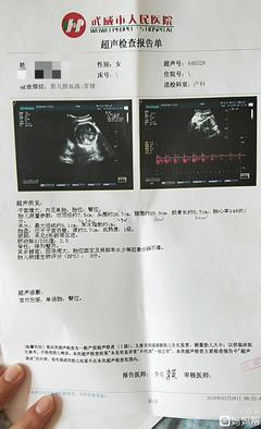 32周胎宝宝