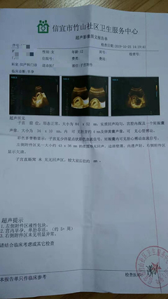 胎儿智障能检查出来吗