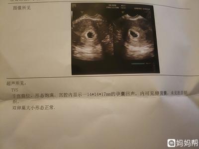 怀孕周期多少周
