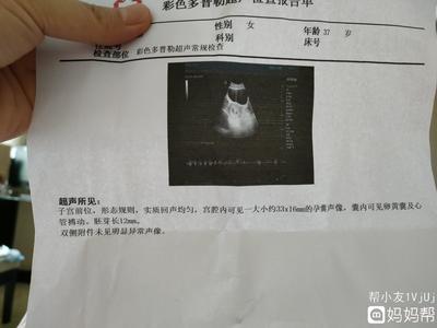 刚好30天能测出怀孕吗