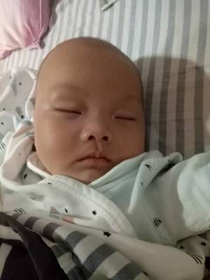 宝宝眼距宽是怎么回事